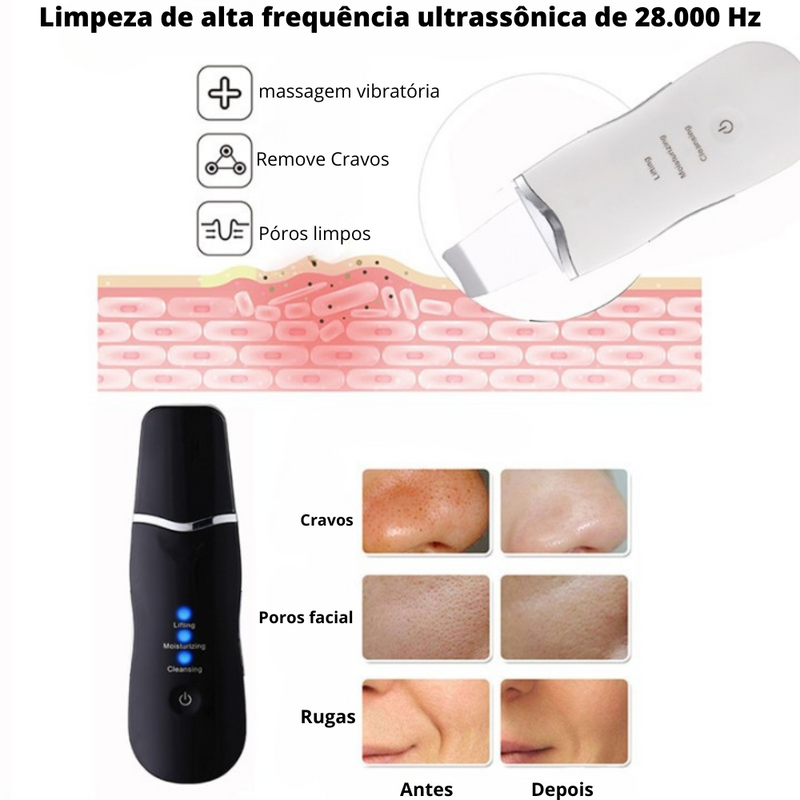 Espátula Peeling Ultrassônico - Para Cravos